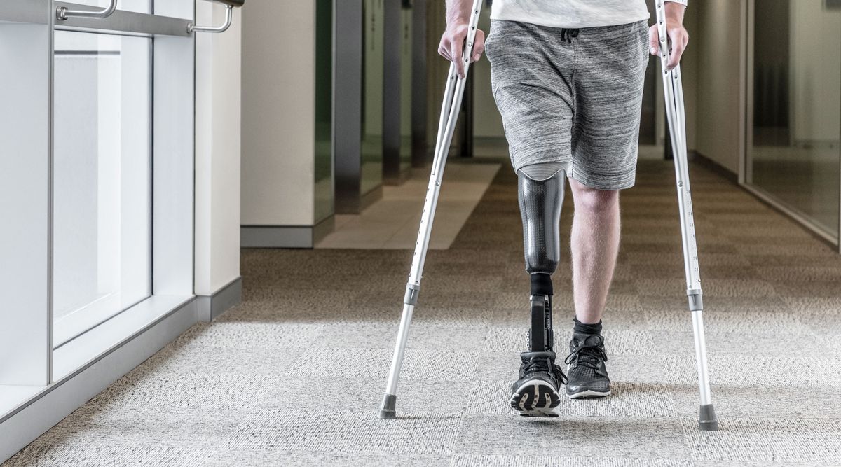 Prosthetic and mobility products